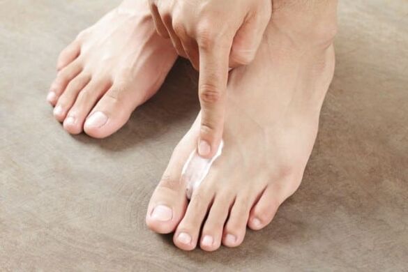 aplikacja maści z grzybicy skóry na nogach